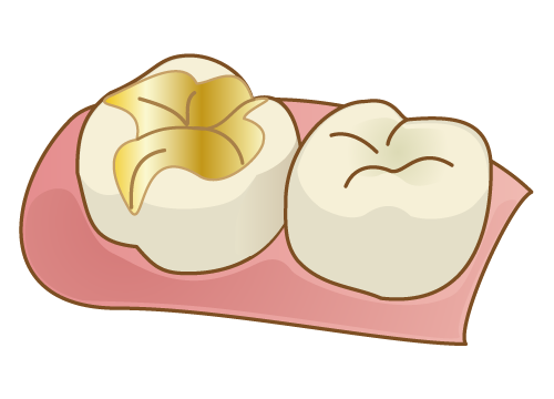 ゴールド